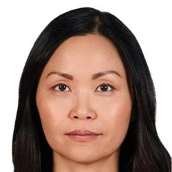 JUVÉDERM® VOLUMA® XC Before & After Patient #1654
